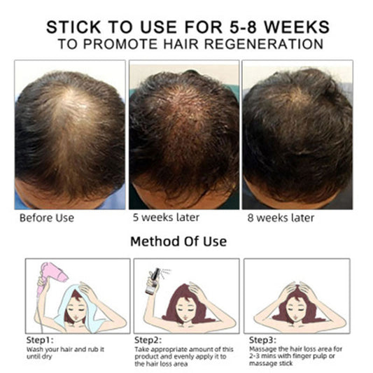 Huile Booster de Pousse – Le Coup de Pouce Naturel pour Ta Barbe et Tes Cheveux