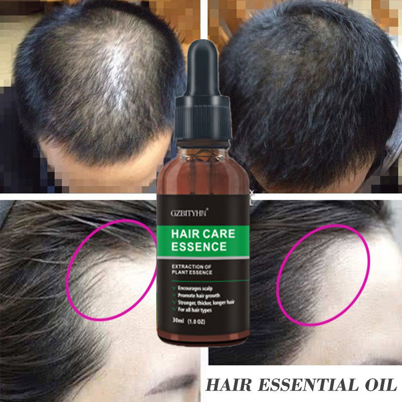 Huile Booster de Pousse – Le Coup de Pouce Naturel pour Ta Barbe et Tes Cheveux